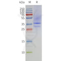 Human MTR1A-Strep full length protein-synthetic nanodisc – Figure 1 of 1