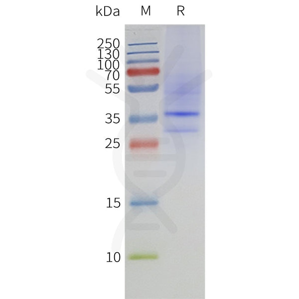 Human MTR1A-Strep full length protein-synthetic nanodisc – Figure 1 of 1