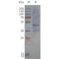 Human MTR1B-Strep full length protein-synthetic nanodisc – Figure 1 of 1