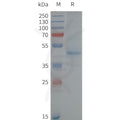 Human NK2R-Strep full length protein-synthetic nanodisc – Figure 1 of 1