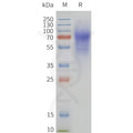 Human HCRTR2-Strep full length protein-synthetic nanodisc – Figure 1 of 1