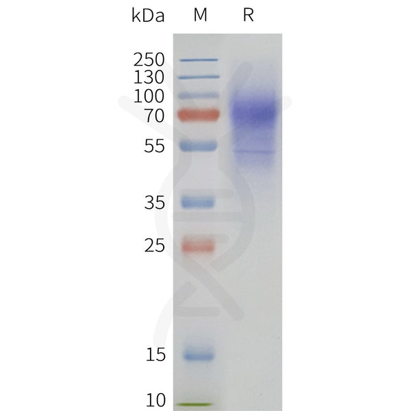 Human HCRTR2-Strep full length protein-synthetic nanodisc – Figure 1 of 1