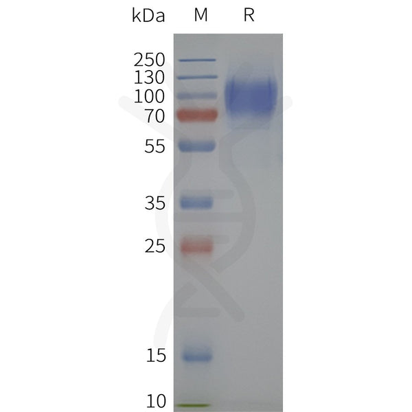 Human PTH1R-Strep full length protein-synthetic nanodisc – Figure 1 of 1