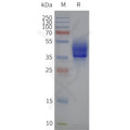 Human S1PR2-Strep full length protein-synthetic nanodisc – Figure 1 of 1