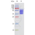 Human S1PR3-Strep full length protein-synthetic nanodisc – Figure 1 of 1