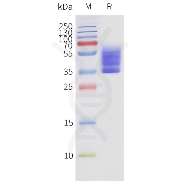 Human S1PR3-Strep full length protein-synthetic nanodisc – Figure 1 of 1