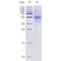 Human BRIL-TAAR1-Strep full length protein-synthetic nanodisc – Figure 1 of 1