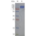 Human SLC34A2-Strep full length protein-synthetic nanodisc – Figure 1 of 1