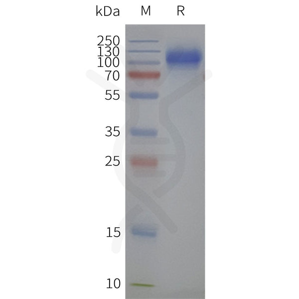 Human SLC34A2-Strep full length protein-synthetic nanodisc – Figure 1 of 1