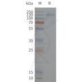 Human KCNH2-Strep full length protein-synthetic nanodisc – Figure 1 of 1