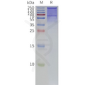 Human SCN8A-Strep full length protein-synthetic nanodisc – Figure 1 of 1