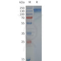 Human TRPC6-Strep full length protein-synthetic nanodisc – Figure 1 of 1