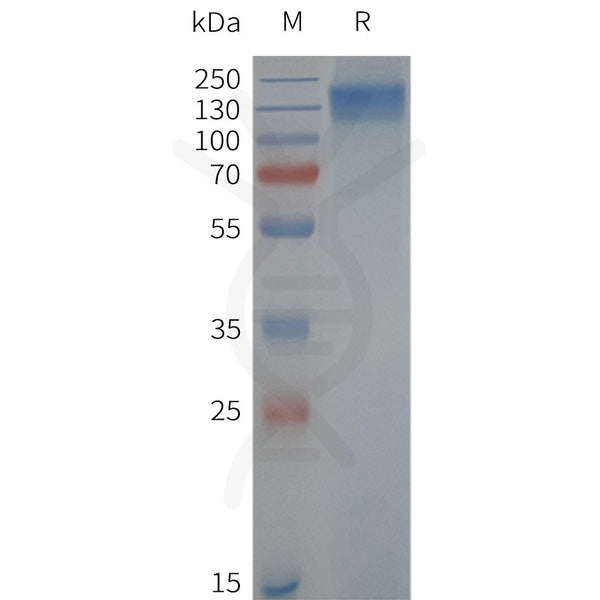 Human TRPC6-Strep full length protein-synthetic nanodisc – Figure 1 of 1