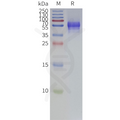 Human P2RX3-Strep full length protein-synthetic nanodisc – Figure 1 of 1