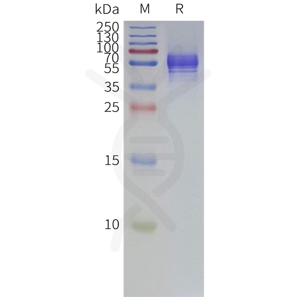 Human P2RX3-Strep full length protein-synthetic nanodisc – Figure 1 of 1