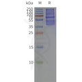 Biotinylated Human CCR2 full length protein-PeptiNanodisc – Figure 1 of 1
