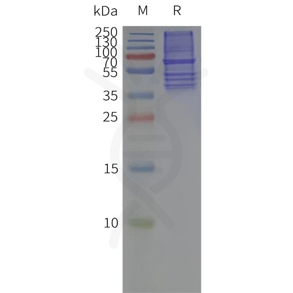 Biotinylated Human CCR2 full length protein-PeptiNanodisc – Figure 1 of 1