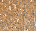CXCR4 Polyclonal Antibody – Figure 1 of 3