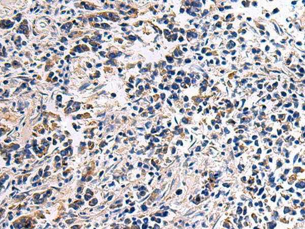 DRGX Polyclonal Antibody – Figure 1 of 2