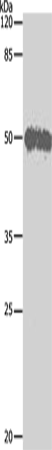 BAG5 Polyclonal Antibody – Figure 1 of 2