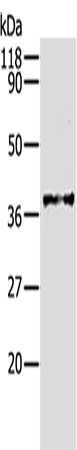 AKR1B1 Polyclonal Antibody – Figure 1 of 3