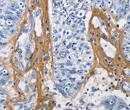 COL3A1 Polyclonal Antibody – Figure 1 of 4