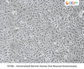Immortalized Normal Human Oral Mucosal Keratinocytes – Figure 1 of 1