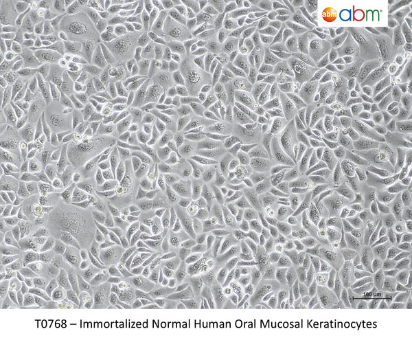 Immortalized Normal Human Oral Mucosal Keratinocytes – Figure 1 of 1
