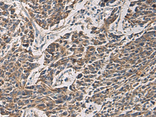 MAPKAPK3 Polyclonal Antibody – Figure 1 of 3