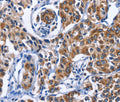 MYH1 Polyclonal Antibody – Figure 1 of 3
