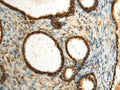 SEPHS1 Polyclonal Antibody – Figure 1 of 3