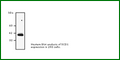 Anti-SCD1 (Mouse Monoclonal) Antibody – Figure 1 of 1