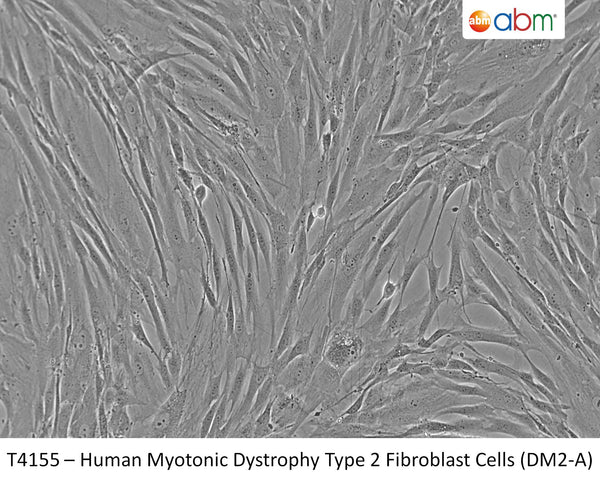 Human Myotonic Dystrophy Type 2 Fibroblast Cells (DM2-A) | Applied Biological Materials (abm)