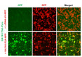GATA1 Reporter Lentivirus – Figure 1