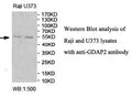 Anti-GDAP2 Antibody – Figure 1 of 1