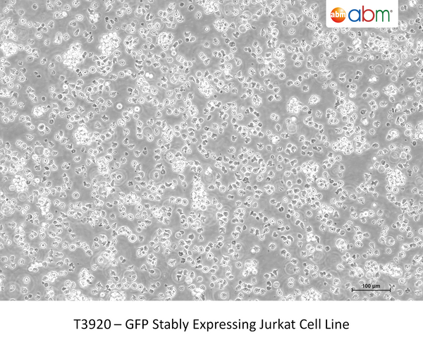 GFP Stably Expressing Jurkat Cell Line – Figure 1 of 1