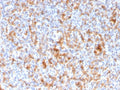 IHC staining of FFPE human spleen with Granzyme B antibody (clone GZMB/3056). HIER: boil tissue sections in pH 9 10mM Tris with 1mM EDTA for 10-20 min and allow to cool before testing.