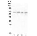 Western blot testing of human 1) PANC-1, 2) U-87 MG, 3) COLO-320 and 4) SGC-7901 cell lysate with CCKBR antibody at 0.5ug/ml. Predicted molecular weight ~48 kDa, but can be observed at 68-97 kDa.