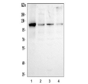 Western blot testing of human 1) U-87 MG, 2) HEL, 3) HepG2 and 4) RT4 cell lysate with Hexokinase II antibody at 0.5ug/ml. Predicted molecular weight ~102 kDa.