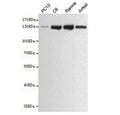 Western blot testing of rat PC12, rat C6, human Ramos and human Jurkat cell lysates using JAK1 antibody at 1:500. Predicted molecular weight ~133 kDa.
