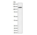 Western blot testing of human HepG2 cell lysate with CDH4 antibody. Expected molecular weight: 100-140 kDa depending on glycosylation level.