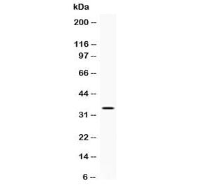 Western blot testing of human A431 cell lysate with NAT1 antibody at 0.5ug/ml. Predicted molecular weight ~34 kDa.