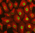 Immunofluorescent staining of RAI1 using anti-RAI1 antibody (green) and anti-Beta Tubulin antibody (red). RAI1 was detected in an immunocytochemical section of cells. Enzyme antigen retrieval was performed using IHC enzyme antigen retrieval reagent for 15 mins. The cells were blocked with 10% goat serum. And then incubated with 5 ug/ml rabbit anti-RAI1 antibody and mouse anti-Beta Tubulin antibody overnight at 4oC.