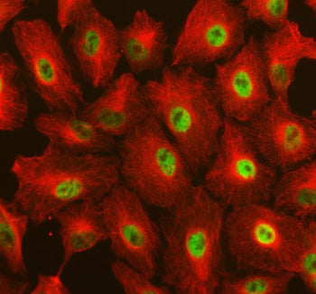 Immunofluorescent staining of RAI1 using anti-RAI1 antibody (green) and anti-Beta Tubulin antibody (red). RAI1 was detected in an immunocytochemical section of cells. Enzyme antigen retrieval was performed using IHC enzyme antigen retrieval reagent for 15 mins. The cells were blocked with 10% goat serum. And then incubated with 5 ug/ml rabbit anti-RAI1 antibody and mouse anti-Beta Tubulin antibody overnight at 4oC.