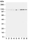Western blot testing of EphA1 antibody and Lane 1: rat liver; 2: (r) lung; 3: (r) intestine; 4: (r) ovary; 5: U87; 6: A549; 7: COLO320; 8: SW620; 9: HeLa cell lysate. Predicted molecular weight: ~108kDa.