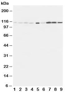 Western blot testing of EphA1 antibody and Lane 1: rat liver; 2: (r) lung; 3: (r) intestine; 4: (r) ovary; 5: U87; 6: A549; 7: COLO320; 8: SW620; 9: HeLa cell lysate. Predicted molecular weight: ~108kDa.