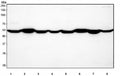 Western blot testing of 1) rat brain, 2) rat skeletal muscle, 3) rat liver, 4) rat C6, 5) mouse brain, 6) mouse skeletal muscle, 7) mouse liver and 8) mouse NIH 3T3 cell lysate with CALR antibody. Predicted molecular weight ~48 kDa but routinely observed at 55~60 kDa.