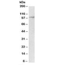 Western blot testing of mouse kidney lysate with Malt1 antibody at 2ug/ml. Predicted molecular weight: ~92kDa.