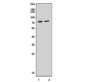 Western blot testing of 1) rat liver and 2) mouse liver tissue lysate with Narc1 antibody. Predicted molecular weight ~74 kDa (pro form).