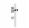 BCMA antibody western blot analysis in MDA-MB231 lysate.